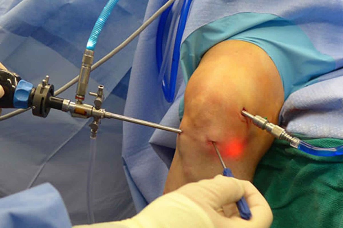 arthrogonato